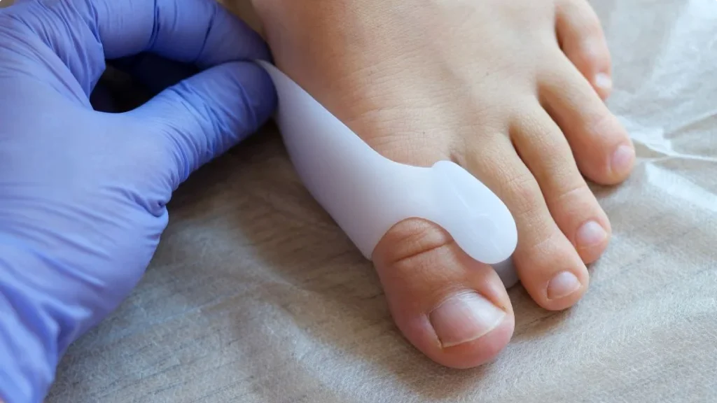 Sehnenscheidenentzündung im Handgelenk – Bracefox Bandagen – Bild 6